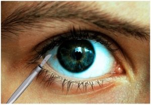 Cataract Eye Surgery