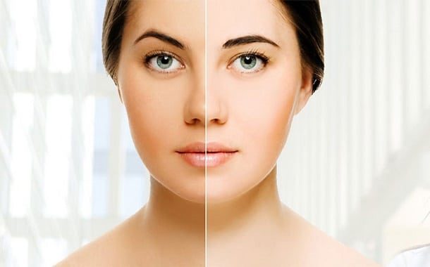 Laser Skin Whitening Cost