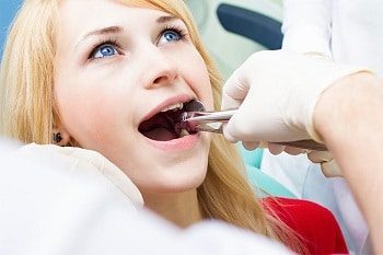 Dental Extraction Young Woman