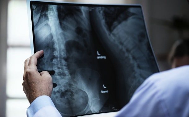 XRay/Radiology Technician School Cost