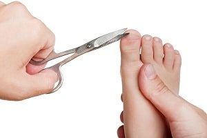 Ingrown Toenail Surgery Cost