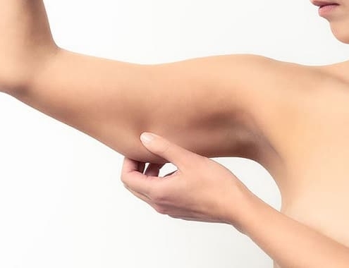 Arm Liposuction Cost
