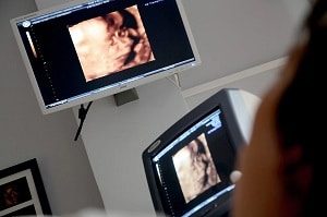 Monitor For Ultrasound