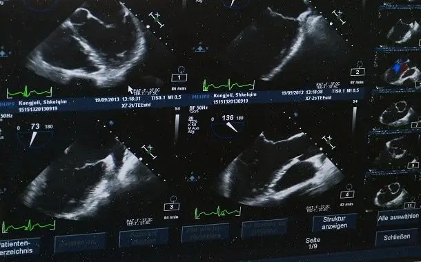 Ultrasound Technician School Cost