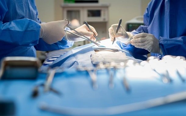Varicoele Surgery Cost