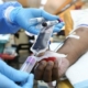 Blood Transfusion Cost