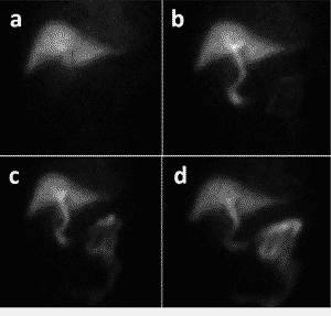 Hida Scan Results