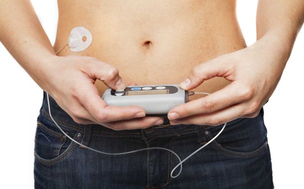 Insulin Pump Cost