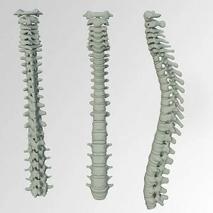 Spine and Back Pain