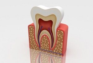 Apiectomy on one tooth