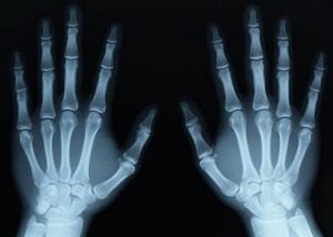 X-ray Hands