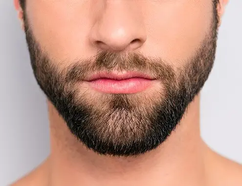 Beard Hair Transplant Cost