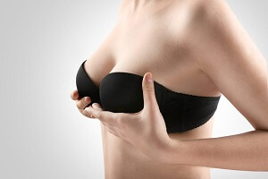 Breast Lift Surgery Explained