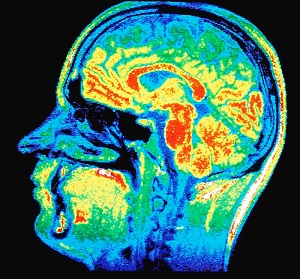 EEG Testing