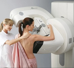 Mammography Example