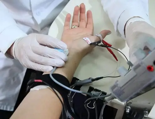 Nerve Conduction Test Cost