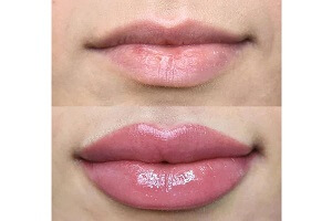 Lip Blushing Before and After