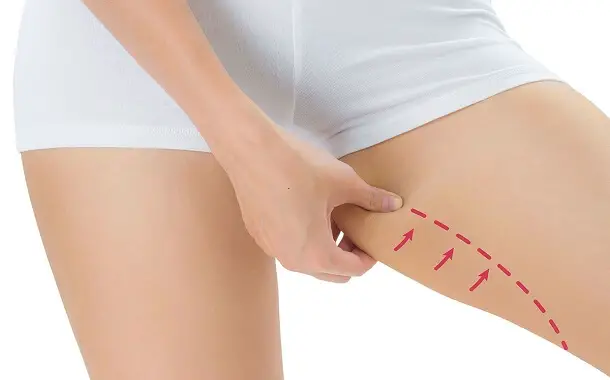 Thigh Lift Cost