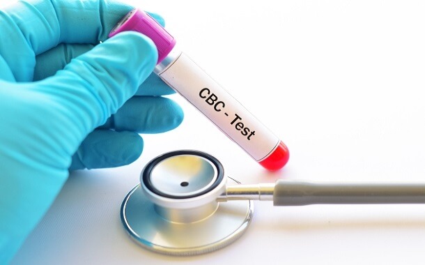 CBC Blood Test Cost