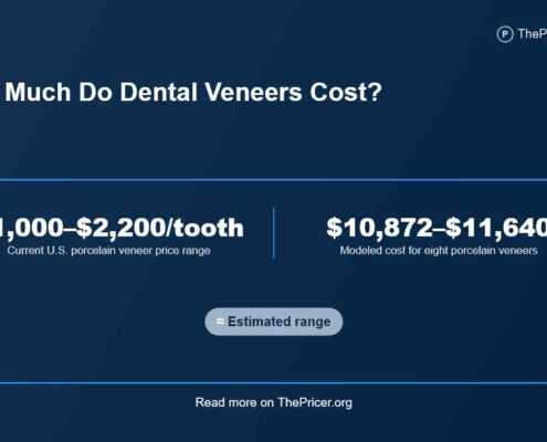 How Much Do Veneers Cost