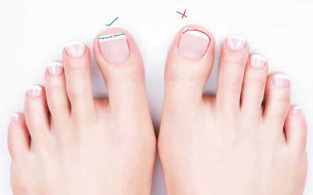 Toenail Cutting Cost