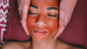 Vampire Facial
