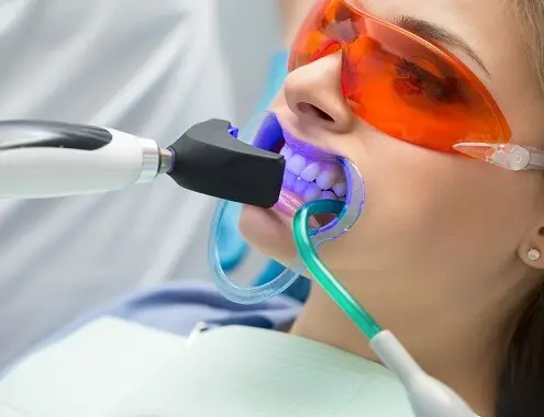 Zoom Whitening Cost