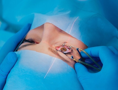 Cornea Transplant Cost