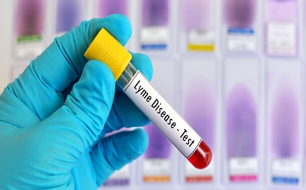 Lyme Disease Testing and Early-Stage Treatment Cost