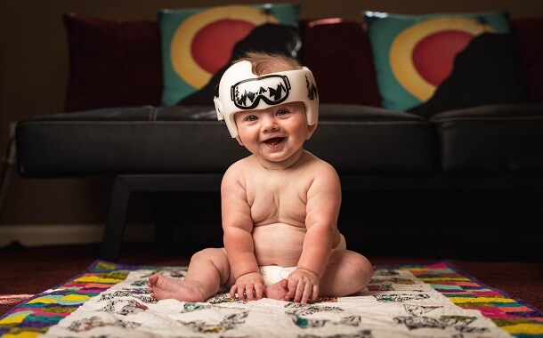 Baby Helmet for Flat Head Cost