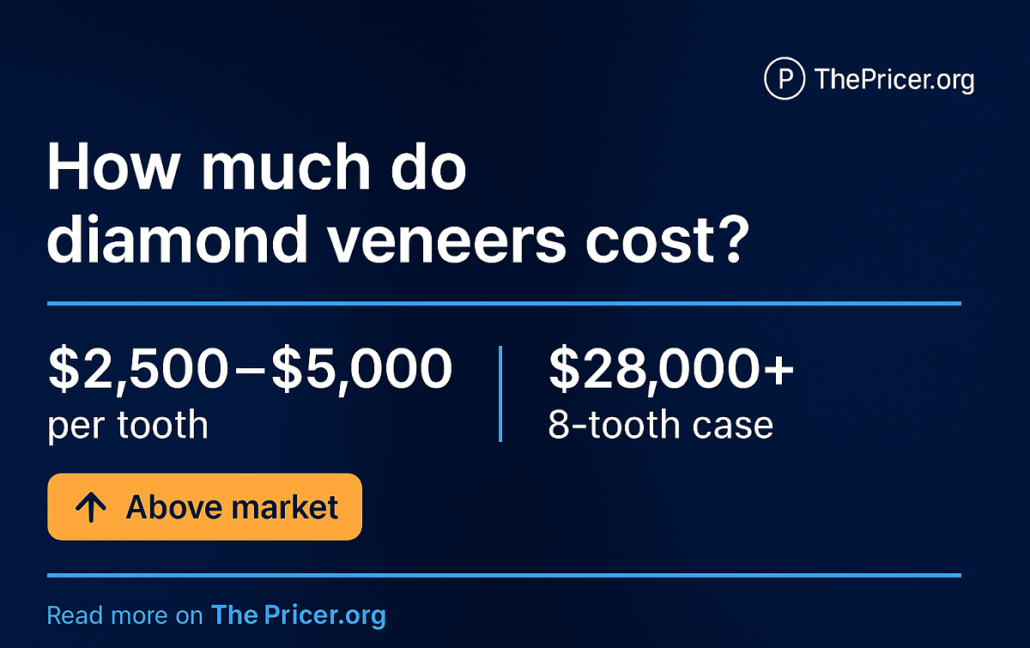 Diamond Veneers Cost
