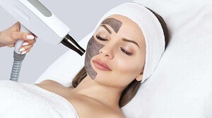 MicroLaser Peel Cost 