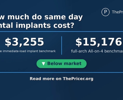 Same Day Dental Implants Cost Card