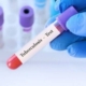How Much Does A TB Test Cost At Walgreens?