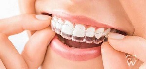 Dental Night Guard