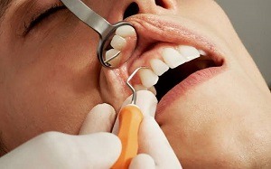 Dental Sedation